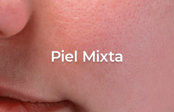 piel mixta