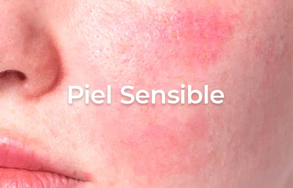 piel sensible skinic